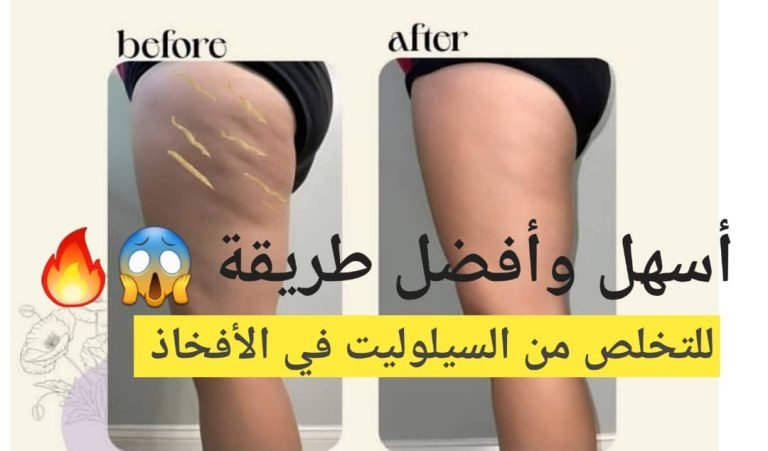 Read more about the article تمارين للتخلص من السيلوليت في الافخاذ