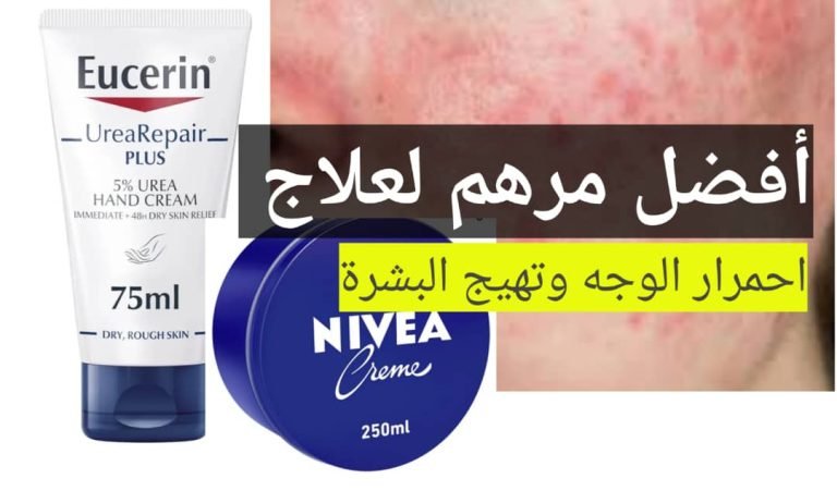 Read more about the article أفضل مرهم لعلاج احمرار الوجه