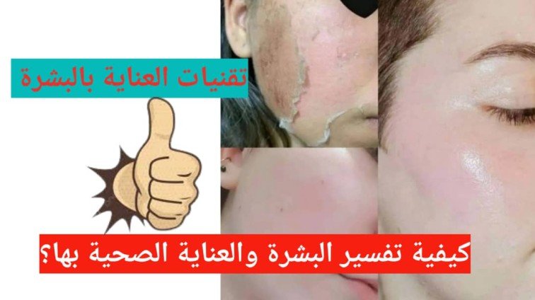 Read more about the article تقنيات العناية بالبشرة (كيفية تقشير البشرة والعناية بها؟)