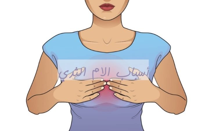 Read more about the article فهم أسباب الام الثدي: كل ما تحتاج معرفته حول هذه الظاهرة الشائعة