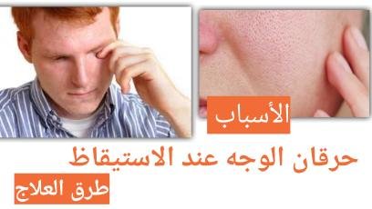 Read more about the article حرقان الوجه عند الاستيقاظ: الأسباب والعلاج