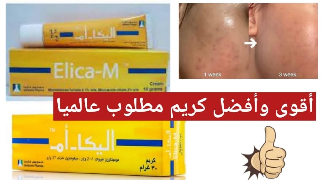 Read more about the article كريم اليكا إم 30 جرام أهم الفوائد والمعلومات!