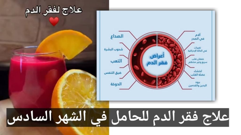Read more about the article علاج فقر الدم للحامل في الشهر السادس: نصائح ومعلومات قيمة