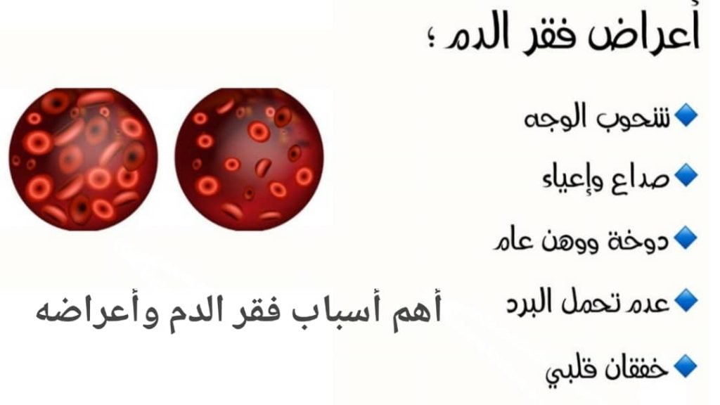 Read more about the article أهم أسباب فقر الدم وأعراضه: دليل شامل لعلاج الحالات الأكثر شيوعًا