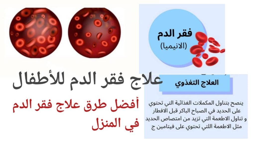 Read more about the article علاج فقر الدم في المنزل: حلول بسيطة لتحسين صحتك