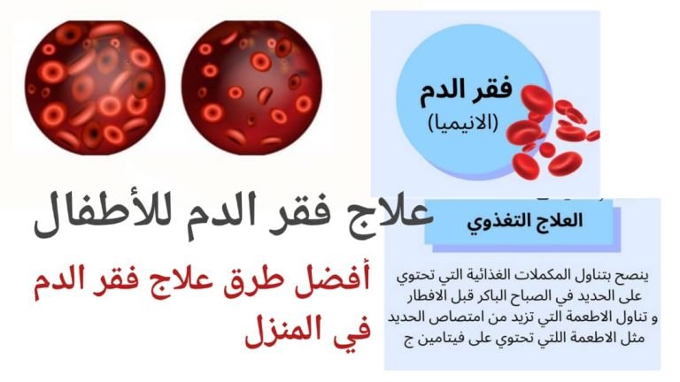 Read more about the article علاج فقر الدم في المنزل: حلول بسيطة لتحسين صحتك