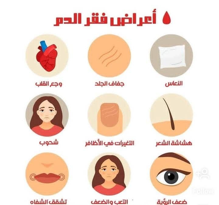 Read more about the article أسباب فقر الدم المفاجئ