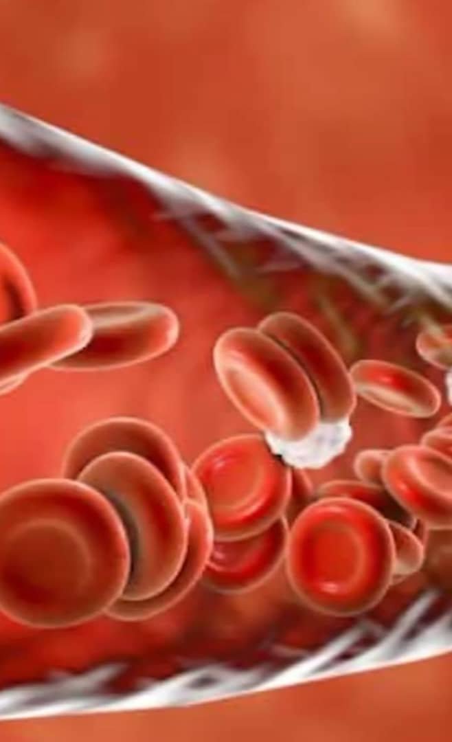 Read more about the article علاج فقر الدم الحاد عند الكبار: دليل شامل للشفاء واستعادة الطاقة
