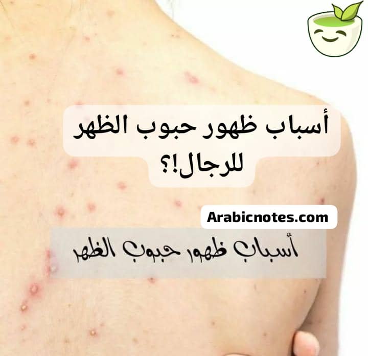 Read more about the article حبوب الظهر عند الرجال: مشكلة جلدية صامتة تكشف الكثير