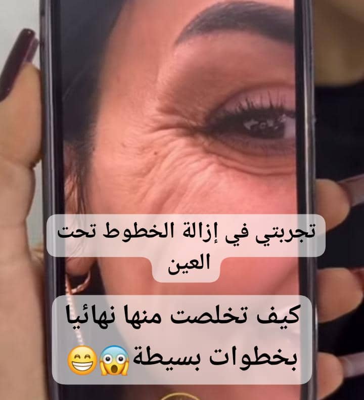 Read more about the article تجربتي في إزالة الخطوط تحت العين: كيف تخلصت منها نهائياً بخطوات بسيطة