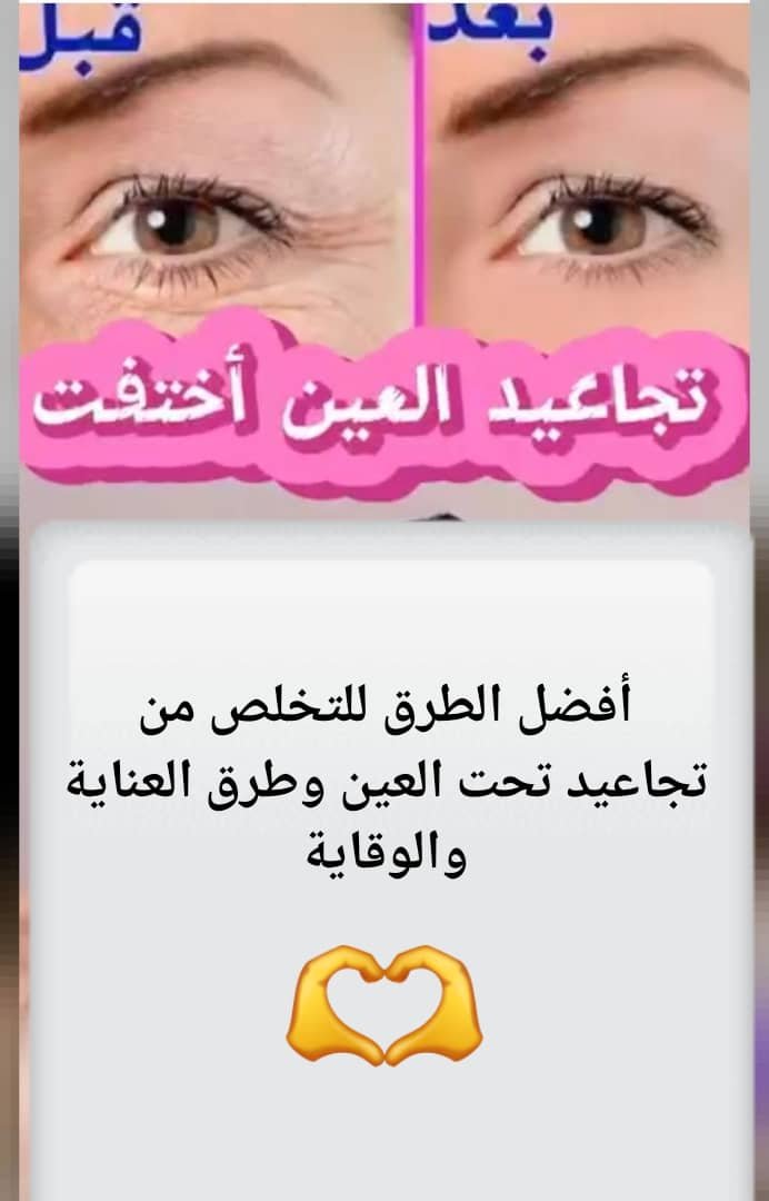 Read more about the article الدليل الشامل للتخلص من تجاعيد تحت العين: إجابات لأكثر الأسئلة شيوعًا وطرق العناية الفعالة