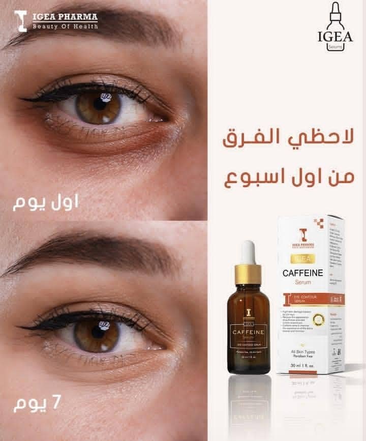 Read more about the article أفضل كريم طبيعي لتجاعيد حول العين: حماية فعّالة وجمال يدوم
