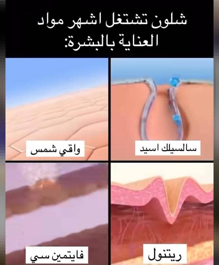 Read more about the article كيف تختار كريم الحماية من الشمس المناسب للبشرة؟ دليل شامل لحماية صحية ومشرقة