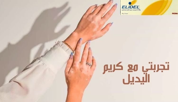Read more about the article تجربتي مع كريم اليديل؛ 7 تعليمات للاستخدام