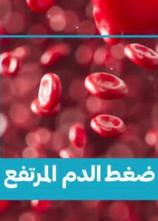 Read more about the article كيف أعرف أن ضغط الدم مرتفع بالرأس دون جهاز